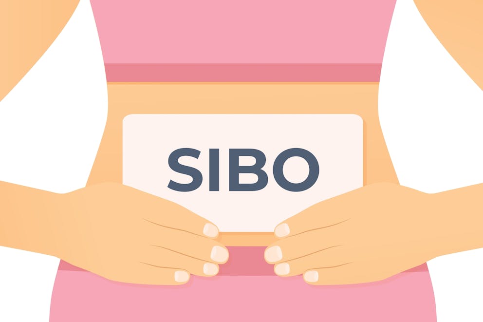 SIBO illustration