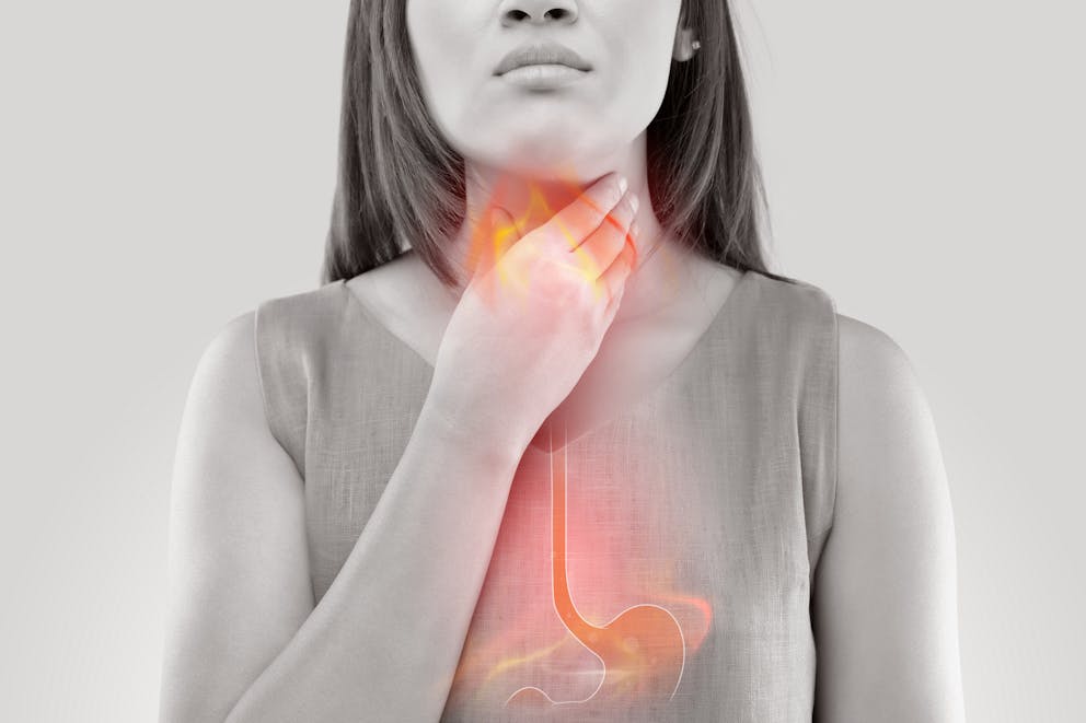 Woman suffering from acid reflux