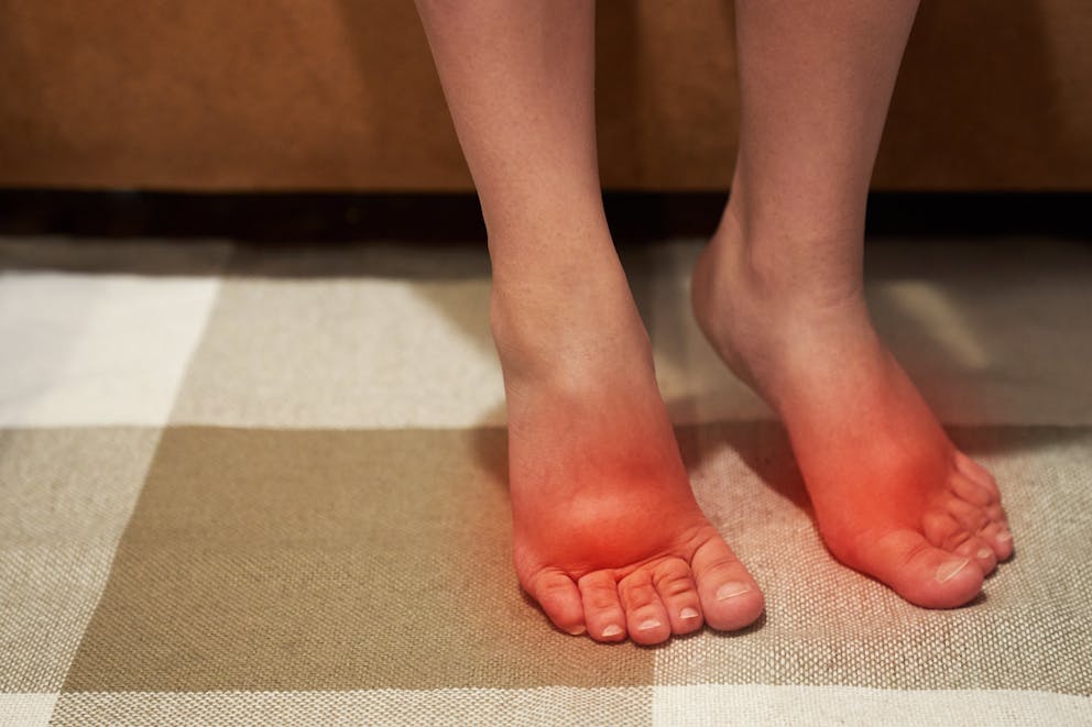 Woman with swollen feet