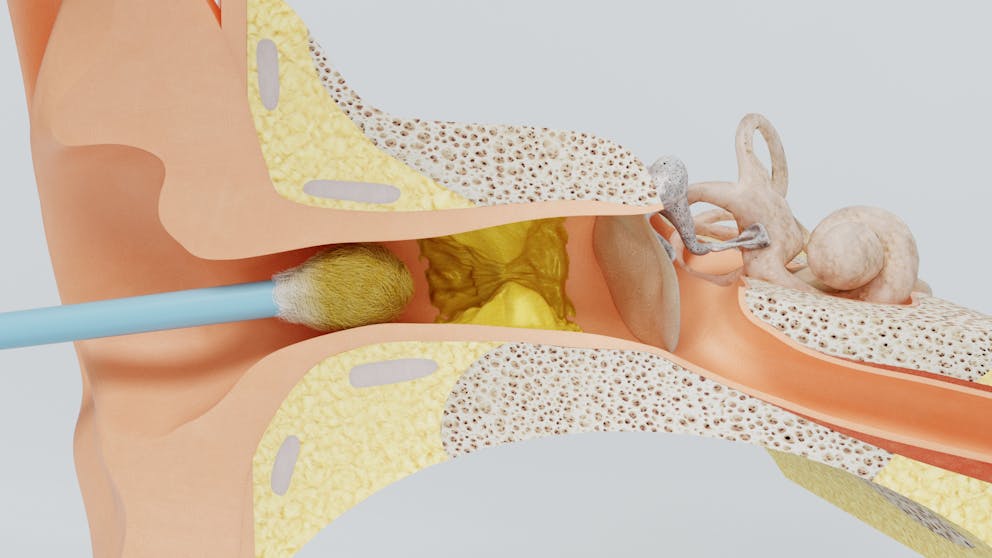 Cotton swap impacting ear wax