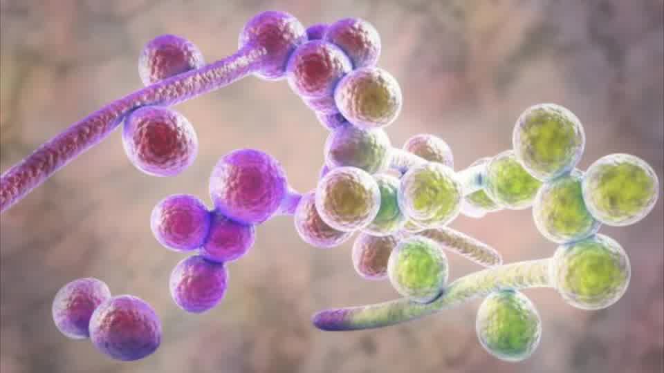 How to Do a Garlic Nasal Rinse Dr. Berg