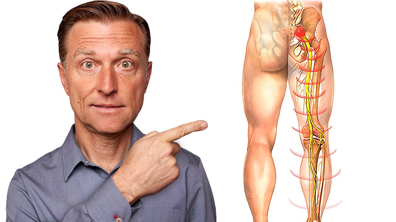 How to Relieve Sciatic Nerve Pain | Dr. Berg