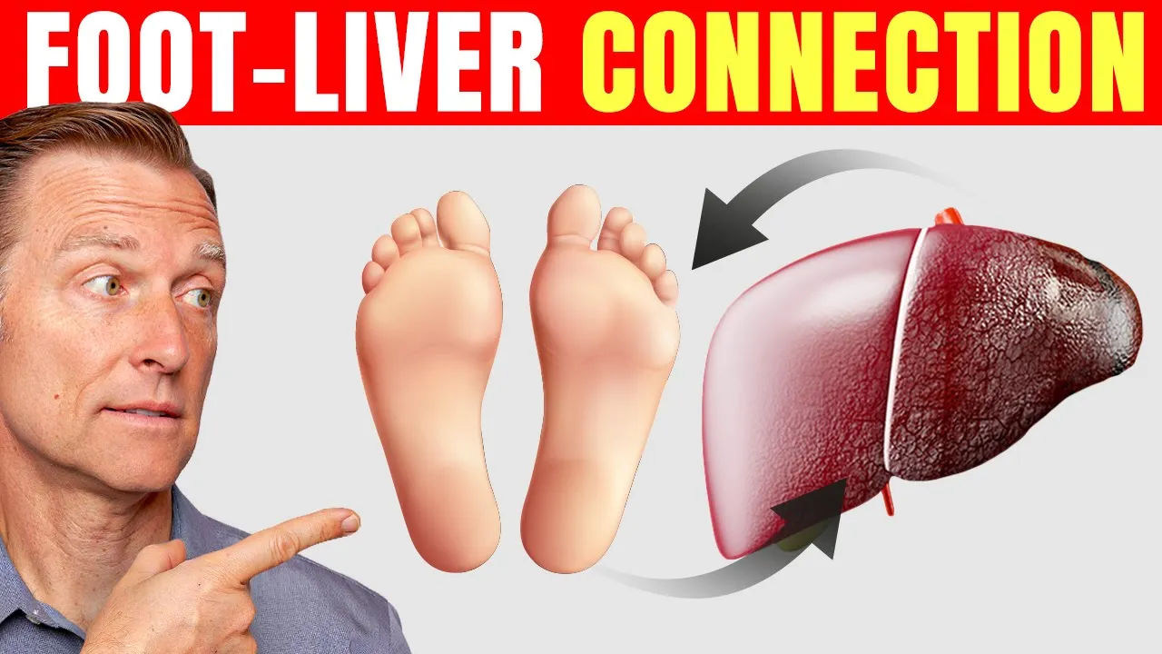 Spot Liver Problems with Foot Diagnosis Dr. Berg