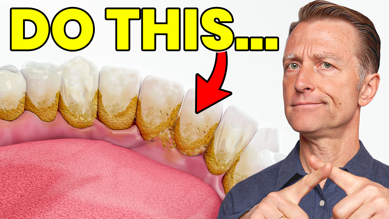 Banish Dental Plaque for Good Dr. Berg's 1 Remedy Revealed