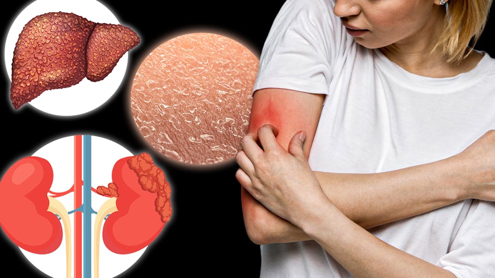 The 15 Causes of ITCHING You've Never Heard About